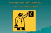 Descripcion Radiografica de Las Fracturas