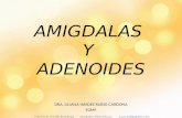 AMIGDALAS Y ADENOIDES