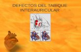Defectos Del Tabique Interauricular