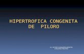 2 Hipertrofia Congenita de Piloro