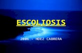 4-12 Clase de Escoliosis