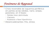 Fen³meno de Raynaud
