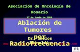 Ablacion De Tumores Por Radiofrecuencia Soc Oncol Ros