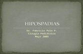 Hipospadias por Fabricio Polo