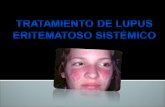 Tratamiento Del Lupus Sistemico