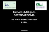Tumores Malignos. OSTEOSARCOMA. DR. IGNACIO LUGO ALVAREZ. R5 RM. OSTEOSARCOMAS,1.