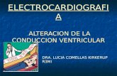 ELECTROCARDIOGRAFIA ALTERACION DE LA CONDUCCION VENTRICULAR DRA. LUCIA COMELLAS KIRKERUP R3MI.