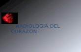 RADIOLOGIA DEL CORAZON. Interpretar las diferentes proyecciones radiológicas que exploran la silueta cardiaca así como los elementos que conforman su.