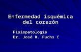 Enfermedad isquémica del corazón Fisiopatología Dr. José R. Fuchs C.