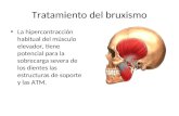 Tratamiento del bruxismo La hipercontracción habitual del músculo elevador, tiene potencial para la sobrecarga severa de los dientes las estructuras de.