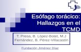 Esófago torácico: Hallazgos en el TCMD T. Presa, B. López-Botet, M.J Fernández, B. Pérez-Villacastín Fundación Jiménez Díaz.