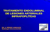 TRATAMIENTO ENDOLUMINAL DE LESIONES ARTERIALES INFRAPOPLÍTEAS DR. S. MERINO LANDALUCE Radiología Intervencionista.