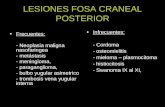 LESIONES FOSA CRANEAL POSTERIOR Frecuentes: - Neoplasia maligna nasofaringea - metástasis - meningioma, - paraganglioma, - bulbo yugular asimetrico - trombosis.