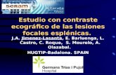 Estudio con contraste ecográfico de las lesiones focales esplénicas. J.A. Jimenez-Lasanta, E. Barluenga, L. Castro, C. Roque, S. Mourelo, A. Olazabal.