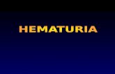HEMATURIA Definición: –Más de cinco (5) eritrocitos por campo de Alto poder (540) en muestra fresca de orina (sedimento urinario) 10-15 ml de orina centrifugada.