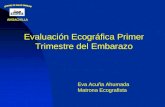 Evaluación Ecográfica Primer Trimestre del Embarazo Eva Acuña Ahumada Matrona Ecografista.