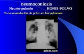 Neumoconiosis Neumo-pulmón KONIS-POLVO Es la acumulación de polvo en los pulmones.