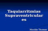 Taquiarritmias Supraventriculares Nicolás Thomas.