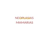 NEOPLASIA NEOPLASIAS MAMARIAS. NEOPLASIA Respuesta adaptativa celular..reversible. Estimulo...cambio en material genético alteración permanente del crecimiento.
