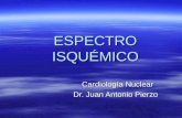 ESPECTRO ISQUÉMICO Cardiología Nuclear Dr. Juan Antonio Pierzo.