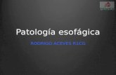 Patología esofágica RODRIGO ACEVES R1CG. Objetivos Trastornos motores Acalasia Espasmo esofágico difuso Esófago en cascanueces EEI hipertenso DivertículosZenkerEsofagitis.