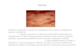 MACULAS Cambio de coloración en la piel, sin modificación de su relieve, consistencia o espesor, se divide en: 1. Maculas vasculares; se ubican las eritematosas.