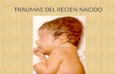 TRAUMAS DEL RECIEN NACIDO. TRAUMAS DEL RN Los traumatismos del recién nacido constituyen un importante capítulo de la patología en esta edad, estimándose.