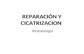 REPARACIÓN Y CICATRIZACION Kinesiología. Generalidades proceso reparativo. Al igual que la inflamación, la reparación y la cicatrización tisular, es un.