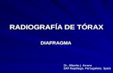 RADIOGRAFÍA DE TÓRAX. PATRONES RADIOLÓGICOS. DIAFRAGMA