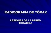 RADIOGRAFÍA DE TÓRAX. PATRONES RADIOLÓGICOS. PARED TORÁCICA