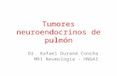 Tumores Neuroendocrinos de Pulmon
