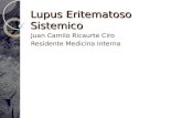 Lupus Eritematoso Sistemico Juan Camilo Ricaurte Ciro Residente Medicina Interna.
