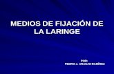 MEDIOS DE FIJACIÓN DE LA LARINGE POR: PEDRO J. ARAUJO RAMÍREZ.
