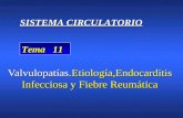Valvulopatías.Etiología,Endocarditis Infecciosa y Fiebre Reumática Tema 11 SISTEMA CIRCULATORIO.