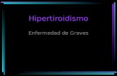 Hipertiroidismo Enfermedad de Graves. Receptor de TSH