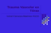 Trauma Vascular en Tórax Ixchel Carranza-Martínez R1CG.