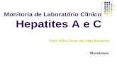 Prof. Nilo César do Vale Baracho Monitoras: Monitoria de Laboratório Clínico Hepatites A e C.