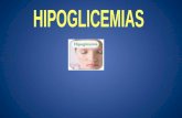 HIPOGLICEMIA SUBIR