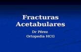 Fracturas Acetabulares Dr Pérez Ortopedia HCG. Tipicamente ocurren de gente joven, son secundarias a traumas de alta energia. Tipicamente ocurren de gente.