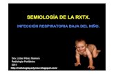 Semiología de la RXTX en la IRB del niño. Parte 1