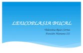 Leucoplasia bucal