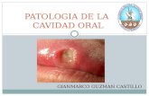 Patologia de la boca y glandulas salivales (Gianmarco Guzman Castillo)