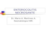 Enterocolitis necrosante 1