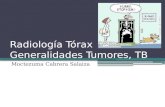 Generalidades rx tórax tumores tb