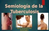 Semiolog­a de la Tuberculosis