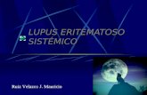 Lupus Eritematoso Sist%C9 Mico