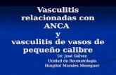 Vasculitis Con ANCA