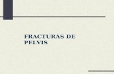 Fracturas de Pelvis