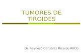 Tumores de Tiroides
