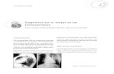 radiologia de bronquiectasia